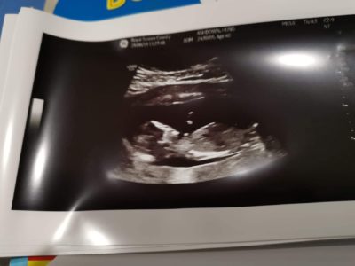 Great times ahead Our baby scan pics 2022